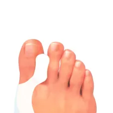 Силіконовий протектор на кісточку Pedag Hallux Toe 277 (277-1861)