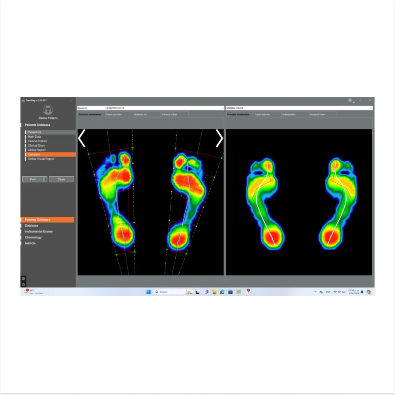 Програмне забезпечення для біомеханічного аналізу freeStep PRO Sensor Medica (freeStep PRO-2484)
