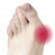 Гелевий протектор на великий палець Vitamed 5th Toe Gel Bunion Pad (F-00042-09-2637)